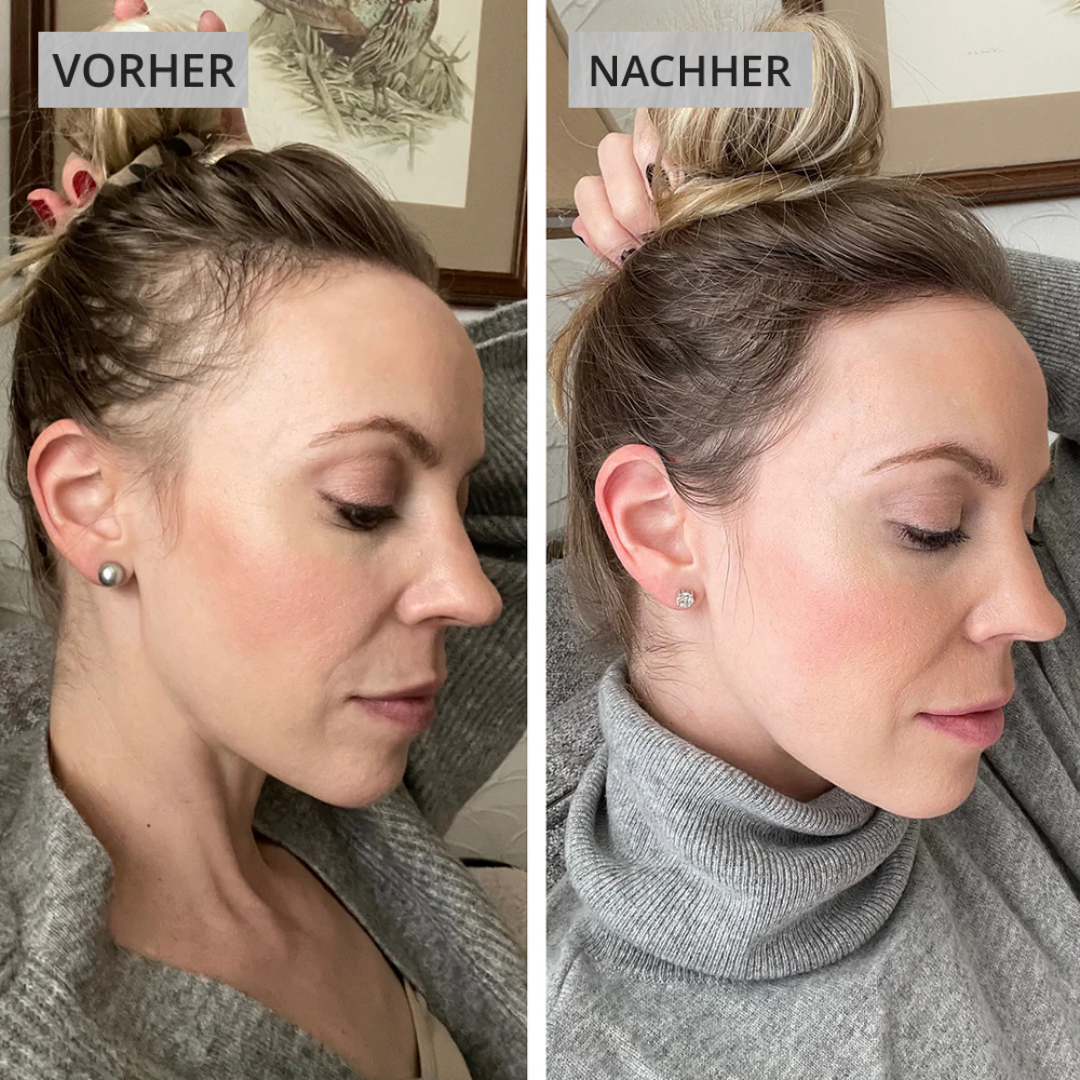 Dermaled® Pro gegen Haarausfall